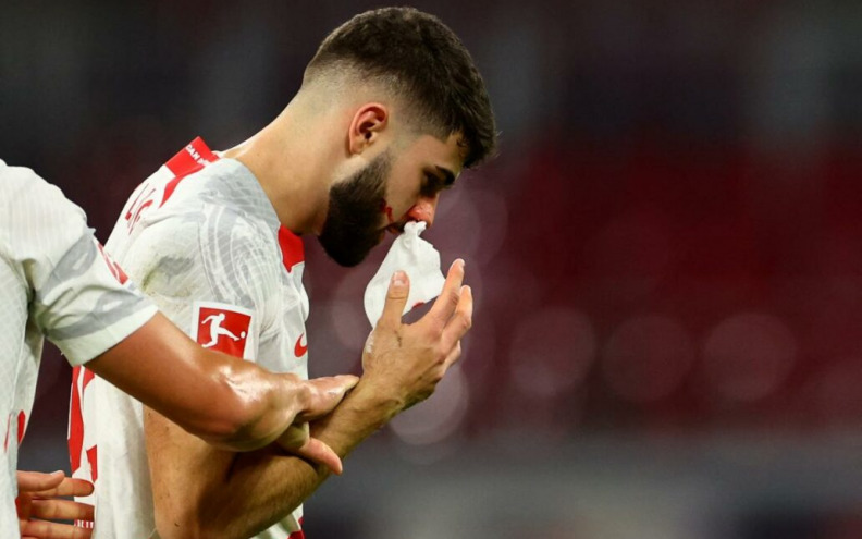 FOTO Gvardiol pokazao kako izgleda nakon sudara sa suigračem
