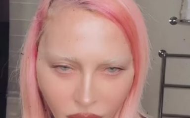 Nakon što je sve šokirala na dodjeli Grammyja, Madonna pokazala kako joj sad izgleda lice