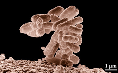 U Europi porast slučajeva zaraze sojem E. coli otpornom na antibiotike