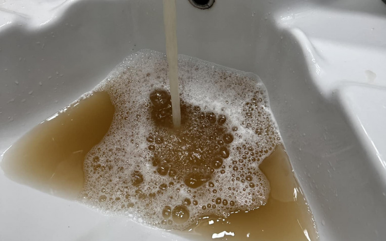 Ogorčena Zadranka: 'Zašto nakon svakih radova voda mora biti ovako prljava?'