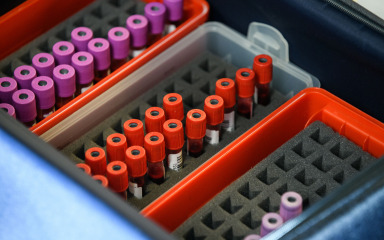 ZABRINJAVAJUĆI REZULTATI Pregledi u pet gradova otkrili patološke promjene na jetri kod četvrtine ispitanih